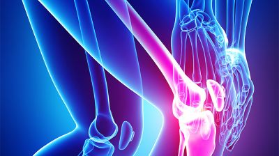 Degenerative Joint Disease,osteoarthritis
